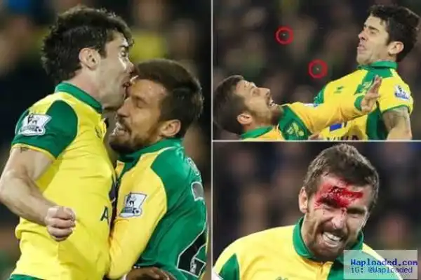Footballer loses teeth after bloody clash with teammate in Chelsea match (Photos)